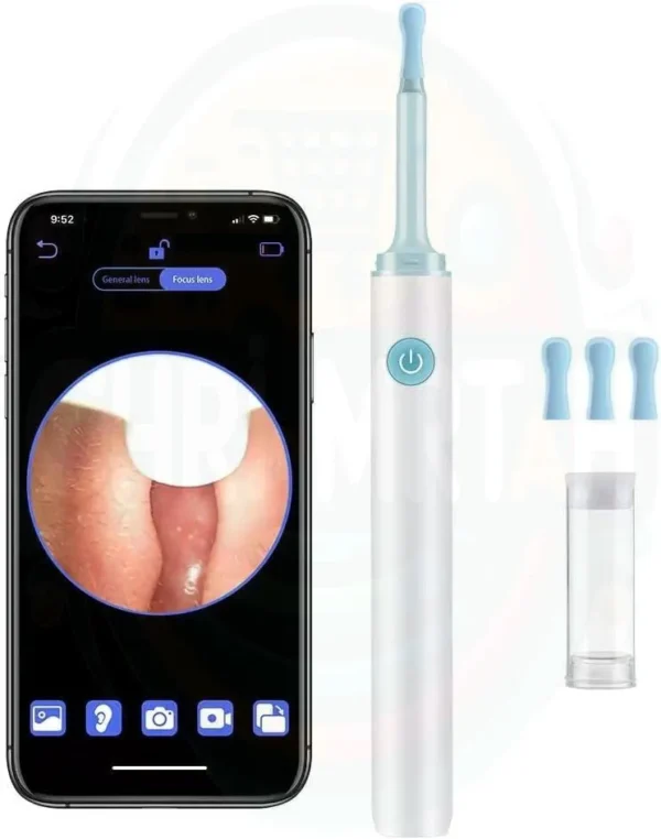 Nettoyant pour les oreilles d'otoscope au Maroc – Image 7