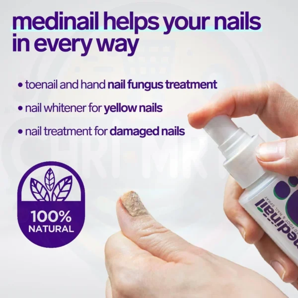 Spray Mycose anti infections Des Ongles au Maroc – Image 5