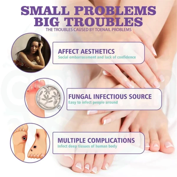 Spray Mycose anti infections Des Ongles au Maroc – Image 9