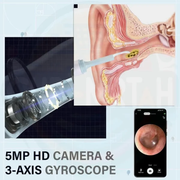 Nettoyant pour les oreilles d'otoscope au Maroc – Image 8